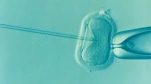 All You Wanted to Know About IVF with TESE