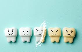 The Hidden Protector: Discovering the Magic of Fissure Sealants